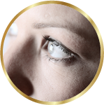 目の下のたるみ・クマ取り